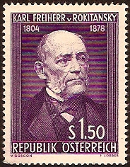 Austria 1954 Von Rokitansky Stamp. SG1254.